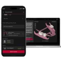 SprintRay NanoPrint - Verbonden software en printbewaking