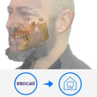 MetiSmile-MR CAD/CAM compatibiliteit