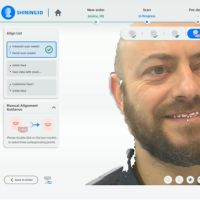 MetiSmile automatische uitlijning